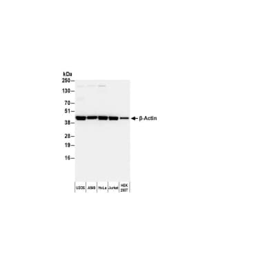 Goat anti-Rabbit IgG Heavy and Light Chain Antibody DyLight® 594 Conjugated