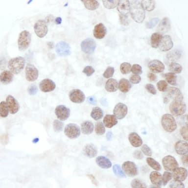 Rabbit anti-Phospho XRCC1 (S518/T519/T523) Antibody, Affinity Purified