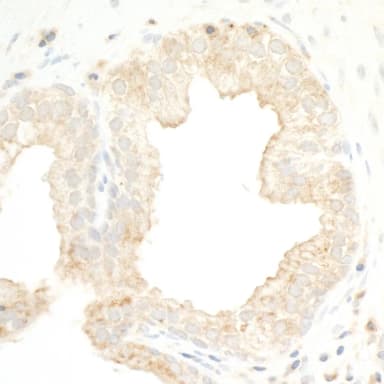 Rabbit anti-PKD2 Antibody, Affinity Purified