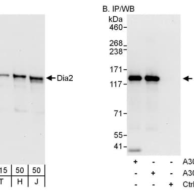 Rabbit anti-Diaphanous 2 Antibody, Affinity Purified