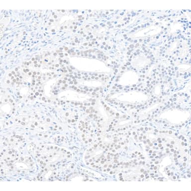 Rabbit anti-Caper Antibody, Affinity Purified