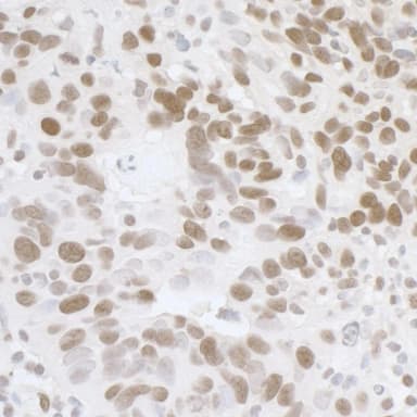 Rabbit anti-FUS Antibody, Affinity Purified