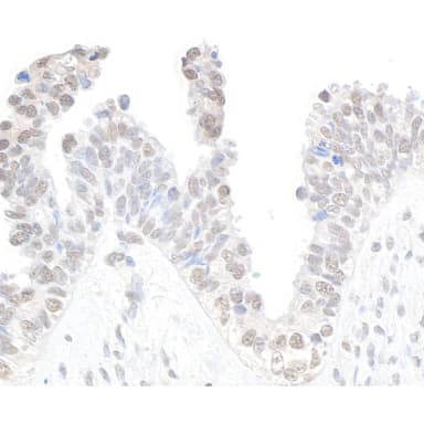 Rabbit anti-CDK11 Antibody, Affinity Purified