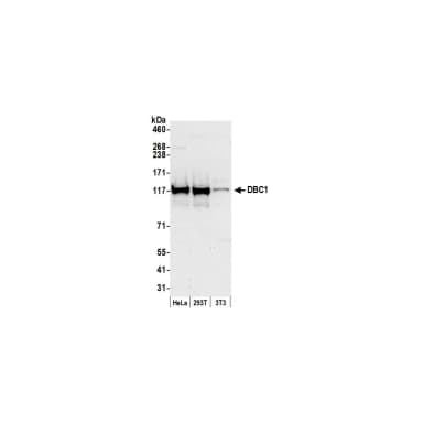 Rabbit anti-DBC1/p30 DBC Antibody, Affinity Purified