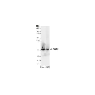 Rabbit anti-RecQ1 Antibody, Affinity Purified