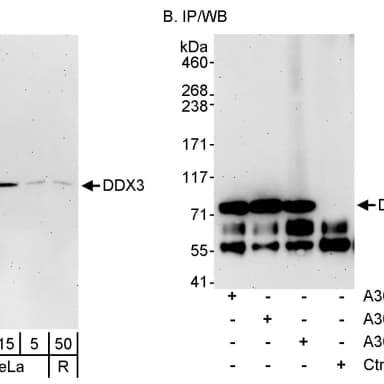 Rabbit anti-DDX3 Antibody, Affinity Purified