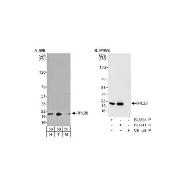 Rabbit anti-RPL26 Antibody, Affinity Purified