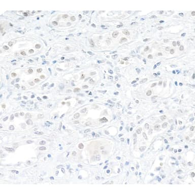 Rabbit anti-DHX9 Antibody, Affinity Purified
