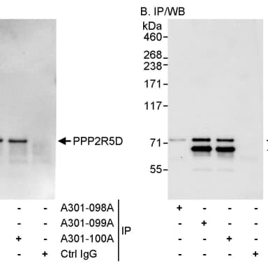 Rabbit anti-PPP2R5D Antibody, Affinity Purified