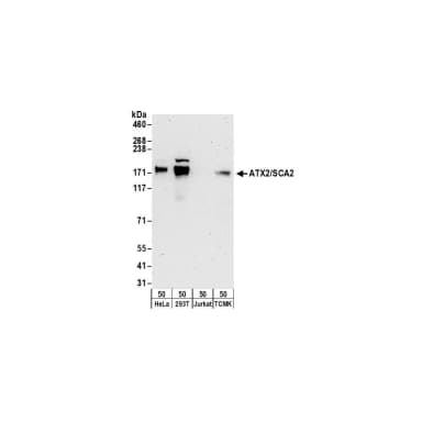 Rabbit anti-ATX2/SCA2 Antibody, Affinity Purified