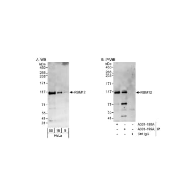 Rabbit anti-RBM12 Antibody, Affinity Purified