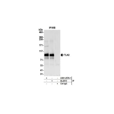 Rabbit anti-TLK2 Antibody, Affinity Purified