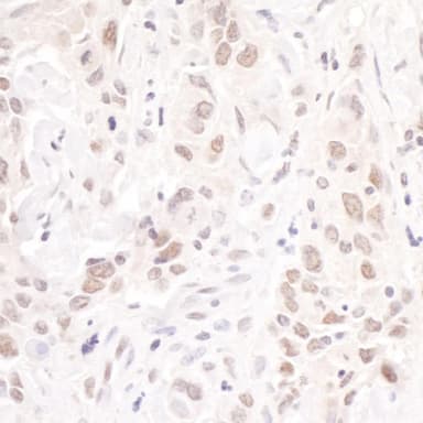Rabbit anti-p66beta/GATAD2B Antibody, Affinity Purified
