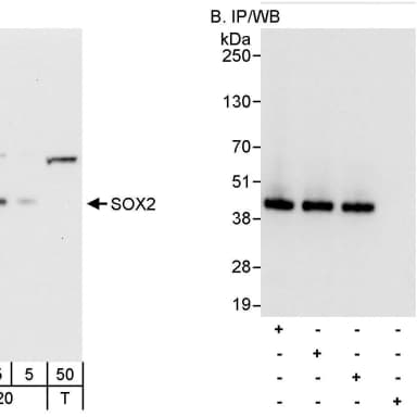 Rabbit anti-SOX2 Antibody, Affinity Purified