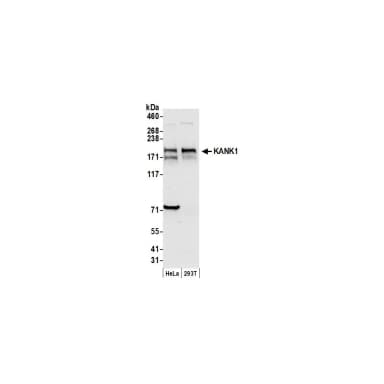 Rabbit anti-KANK1 Antibody, Affinity Purified