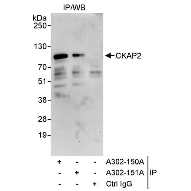 Rabbit anti-CKAP2 Antibody, Affinity Purified