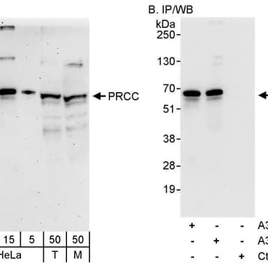 Rabbit anti-PRCC Antibody, Affinity Purified