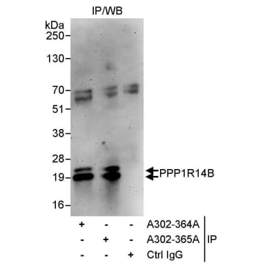 Rabbit anti-PPP1R14B Antibody, Affinity Purified