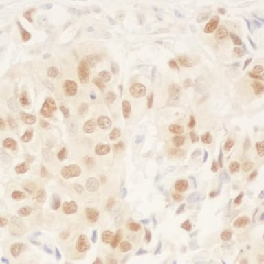 Rabbit anti-NRIP Antibody, Affinity Purified