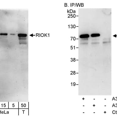 Rabbit anti-RIOK1 Antibody, Affinity Purified