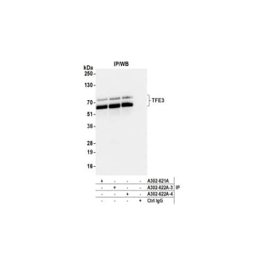 Rabbit anti-TFE3 Antibody, Affinity Purified
