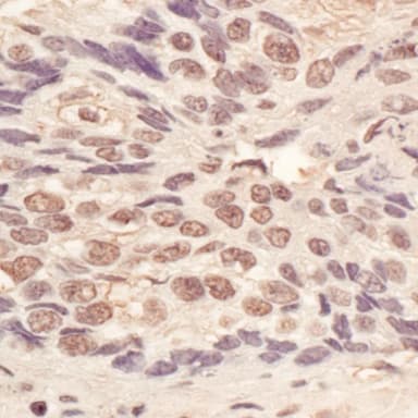 Rabbit anti-L3MBTL3 Antibody, Affinity Purified