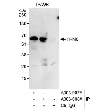 Rabbit anti-TRM6 Antibody, Affinity Purified