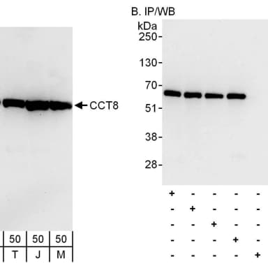 Rabbit anti-CCT8 Antibody, Affinity Purified