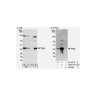 Rabbit anti-Pfetin Antibody, Affinity Purified