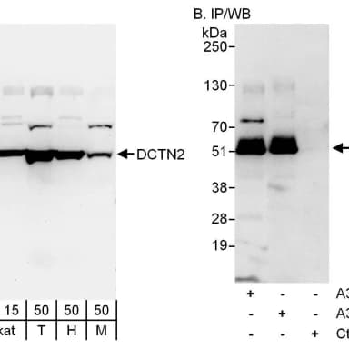 Rabbit anti-DCTN2 Antibody, Affinity Purified