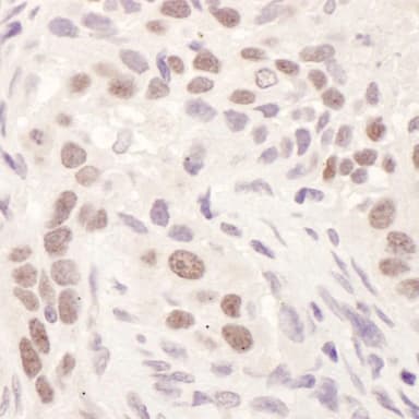 Rabbit anti-GR Antibody, Affinity Purified