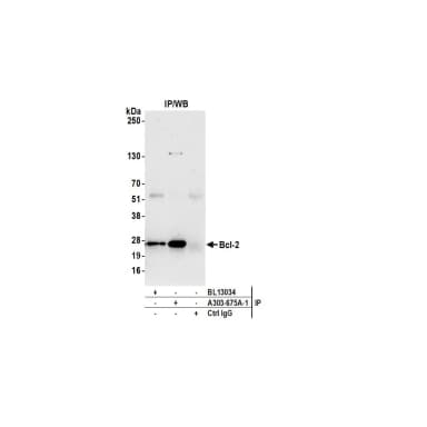 Rabbit anti-Bcl-2 Antibody, Affinity Purified