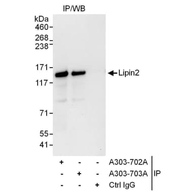 Rabbit anti-Lipin2 Antibody, Affinity Purified