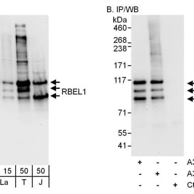 Rabbit anti-RBEL1 Antibody, Affinity Purified
