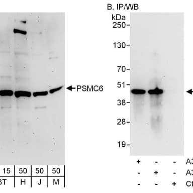 Rabbit anti-PSMC6 Antibody, Affinity Purified