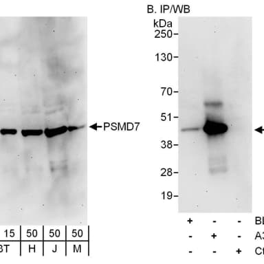 Rabbit anti-PSMD7 Antibody, Affinity Purified