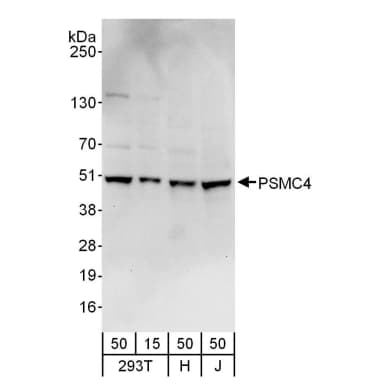 Rabbit anti-PSMC4 Antibody, Affinity Purified