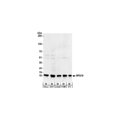 Rabbit anti-RPS19 Antibody, Affinity Purified
