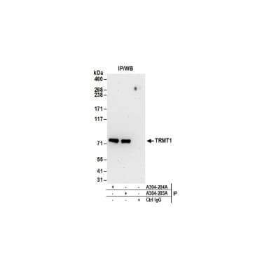 Rabbit anti-TRMT1 Antibody, Affinity Purified