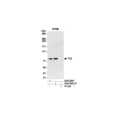 Rabbit anti-TG2 Antibody, Affinity Purified