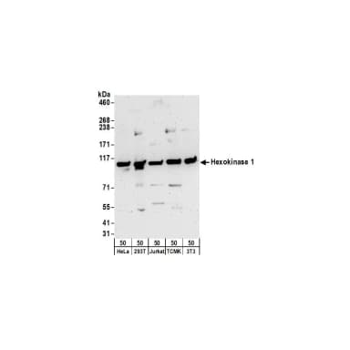 Rabbit anti-Hexokinase 1 Antibody, Affinity Purified