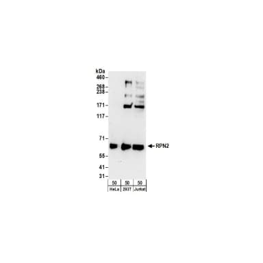 Rabbit anti-RPN2 Antibody, Affinity Purified
