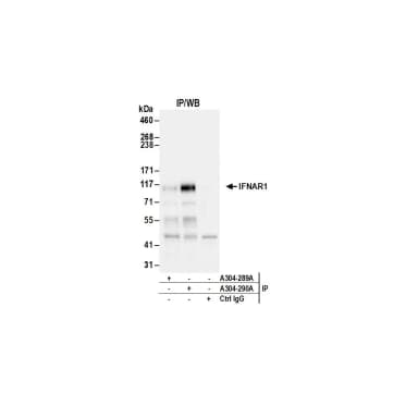 Rabbit anti-IFNAR1 Antibody, Affinity Purified