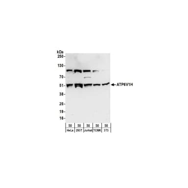 Rabbit anti-ATP6V1H Antibody, Affinity Purified