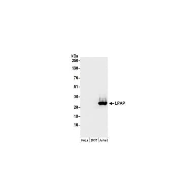 Rabbit anti-LPAP Antibody, Affinity Purified