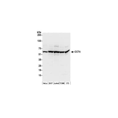 Rabbit anti-CCT4 Antibody, Affinity Purified