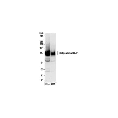 Rabbit anti-Calpastatin/CAST Antibody, Affinity Purified