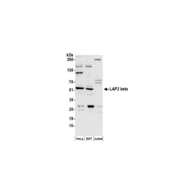 Rabbit anti-LAP2 beta/TMPO Antibody, Affinity Purified