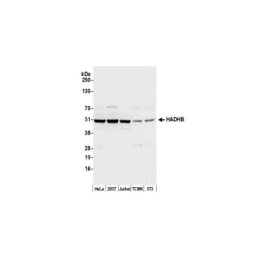Rabbit anti-HADHB Antibody, Affinity Purified