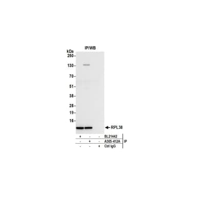Rabbit anti-RPL38/Ribosomal Protein L38 Antibody, Affinity Purified